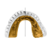 Капа OPRO Gold Braces під брекети доросла (вік 11+) White/Gold (art.102506004)